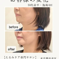 画像339