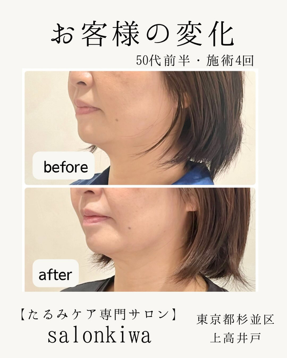 画像339