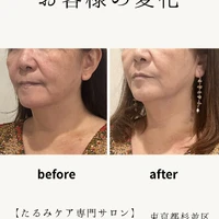 画像370