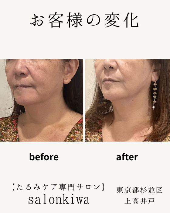 画像370